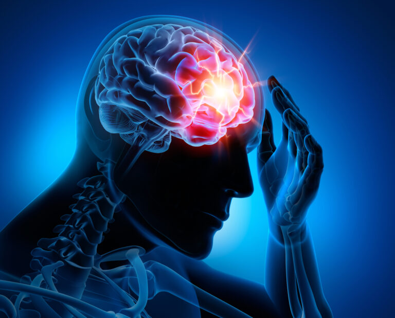 What Is CTE?